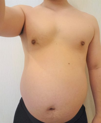 樟葉の整骨院でダイエット