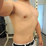 楠葉の整骨院でダイエット